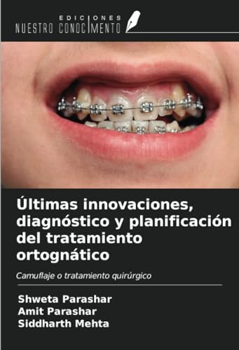 9786206639800: ltimas innovaciones, diagnstico y planificacin del tratamiento ortogntico: Camuflaje o tratamiento quirrgico