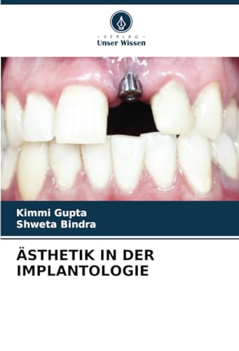 Stock image for STHETIK IN DER IMPLANTOLOGIE (German Edition) for sale by Mispah books