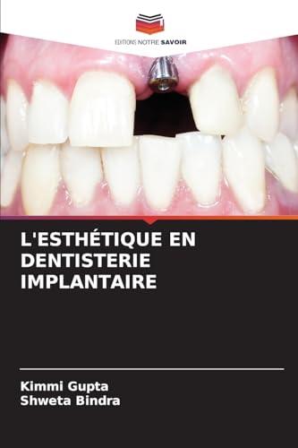 Stock image for L*Esth tique En Dentisterie Implantaire (French Edition) for sale by Mispah books