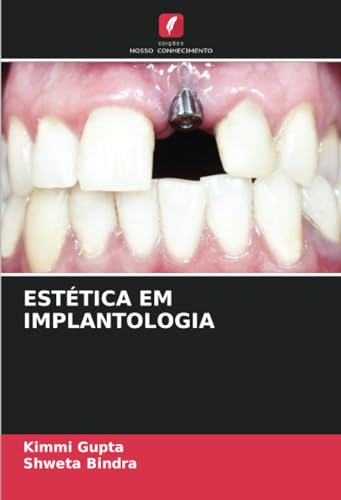 Stock image for EST TICA EM IMPLANTOLOGIA (Portuguese Edition) for sale by Mispah books