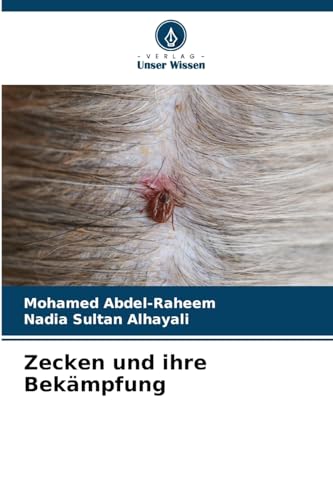 9786206902058: Zecken und ihre Bekmpfung (German Edition)