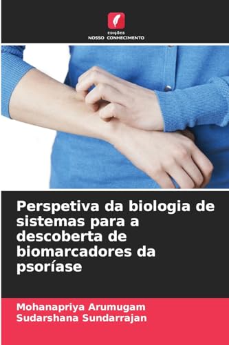 Beispielbild fr Perspetiva da biologia de sistemas para a descoberta de biomarcadores da psorase (Portuguese Edition) zum Verkauf von ALLBOOKS1