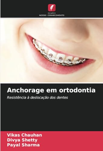 9786207242795: Anchorage em ortodontia: Resistncia  deslocao dos dentes