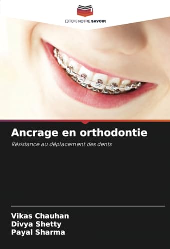 9786207242818: Ancrage en orthodontie: Rsistance au dplacement des dents