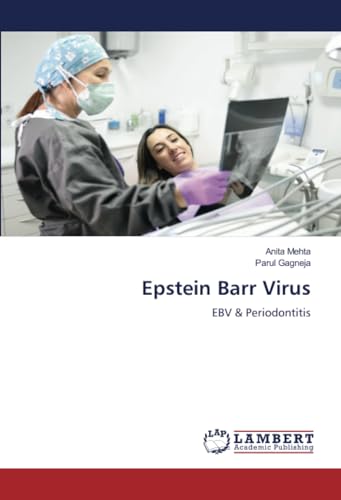 Imagen de archivo de Epstein Barr Virus a la venta por BuchWeltWeit Ludwig Meier e.K.