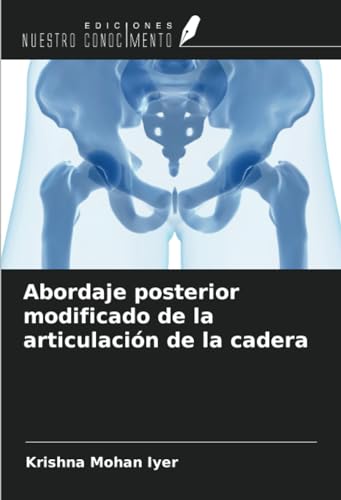 9786207499342: Abordaje posterior modificado de la articulacin de la cadera