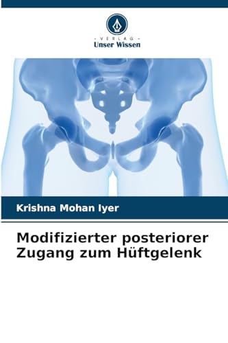 Stock image for Modifizierter posteriorer Zugang zum Hftgelenk for sale by BuchWeltWeit Ludwig Meier e.K.