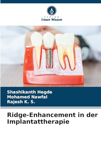 Beispielbild fr Ridge-Enhancement in der Implantattherapie (German Edition) zum Verkauf von Ria Christie Collections