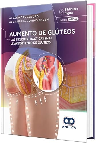 Stock image for Aumento de Glúteos. Las Mejores Prácticas en el Levantamiento de Glúteos for sale by AG Library
