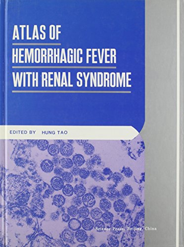 Atlas of Hemorrhagic Fever with Renal Syndrome