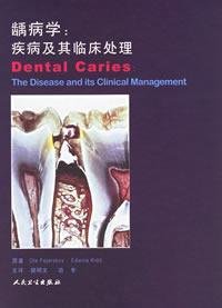 Imagen de archivo de Dental caries(Chinese Edition) a la venta por liu xing