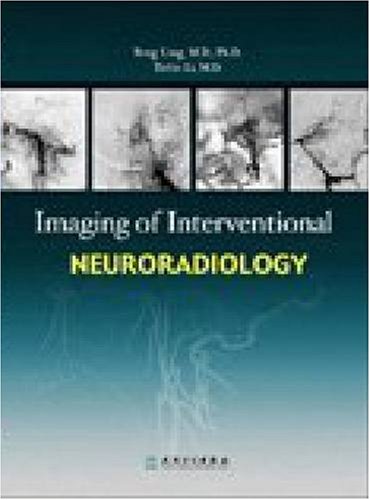 Imagen de archivo de Imaging of Interventional Neuroradiology a la venta por Goodwill Southern California
