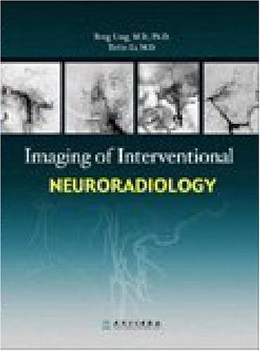 Stock image for Imaging of Interventional Neuroradiology for sale by Goodwill Southern California