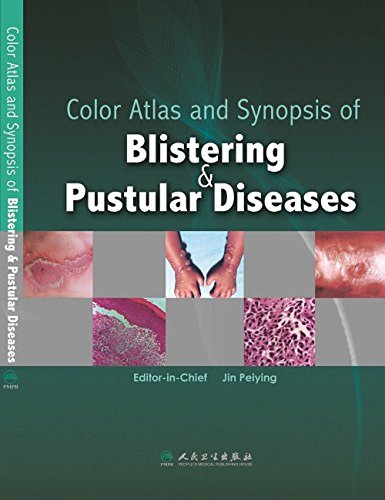 Stock image for Color Atlas and Synopsis of Blistering and Pustular Diseases for sale by Anybook.com