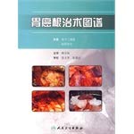 9787117116695: Gastrectomy map(Chinese Edition)