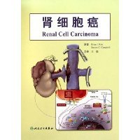 Stock image for renal cell carcinoma [paperback](Chinese Edition) for sale by liu xing