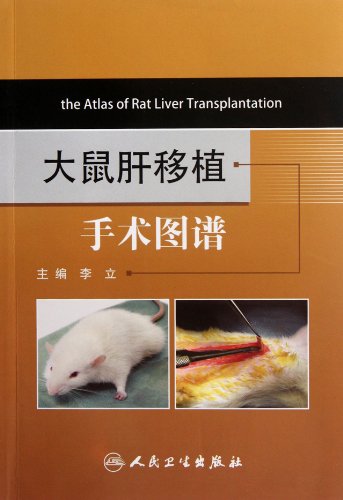 9787117156820: The Atlas of Rat Liver Transplantation (Chinese Edition)