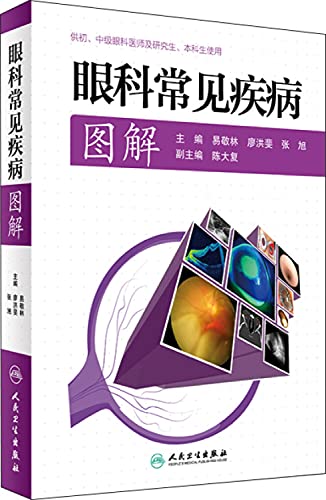 9787117229142: Ophthalmology common disease illustration(Chinese Edition)