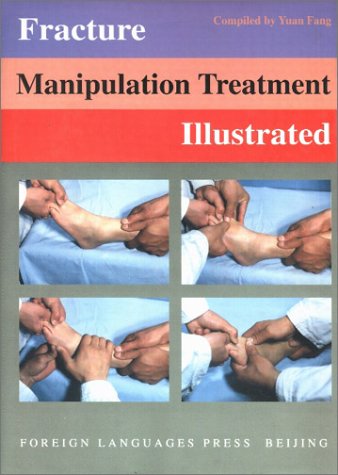 Fracture Manipulation Treatment Illustrated