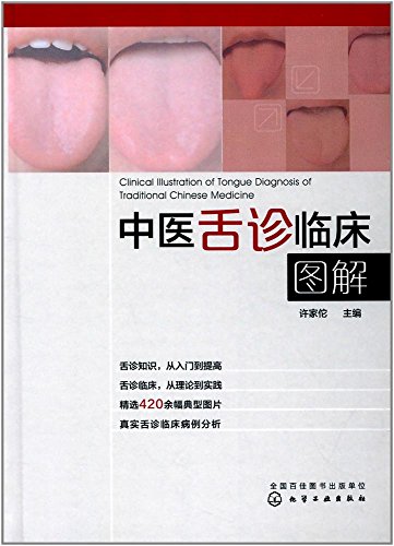 9787122305527: 中医舌诊临床图解 舌诊 许佗 400余幅典型舌象图 舌象的正常与异常 中医理论 解读中医舌诊舌诊断病看舌苔书中医快速入门图书籍