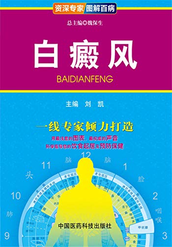 9787506765473: Graphic riddled senior experts: Vitiligo(Chinese Edition)