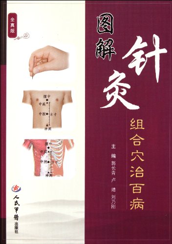 9787509153345: Combination of Acupuncture Point Curing all Disease in Graphic-Genuine Edition (Chinese Edition)