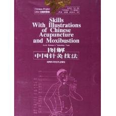 Imagen de archivo de English-Chinese Books About Chinese Medicine-Illustrated Chinese Acupuncture Therapies (Chinese Edition) a la venta por ThriftBooks-Atlanta