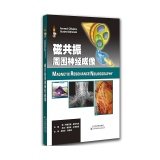 Imagen de archivo de Magnetic resonance imaging of peripheral nerve(Chinese Edition) a la venta por liu xing