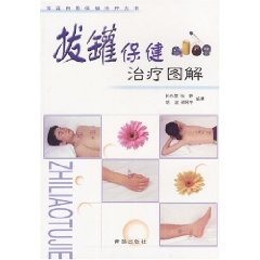 Stock image for cupping health Treatment of graphic (Paperback) for sale by ThriftBooks-Dallas