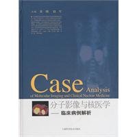 9787547805091: Molecular Imaging and Nuclear Medicine: Clinical Case Analysis(Chinese Edition)