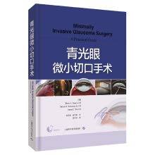 Stock image for Glaucoma small incision surgery(Chinese Edition) for sale by Opalick