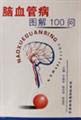 Imagen de archivo de The cerebrovascular diseases graphic 100 asked(Chinese Edition) a la venta por liu xing