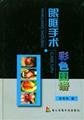 9787810603300: Color Atlas of orbital surgery (hardcover)(Chinese Edition)