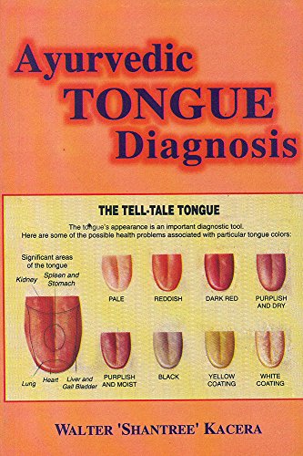 9788120832312: Ayurvedic Tongue Diagnosis