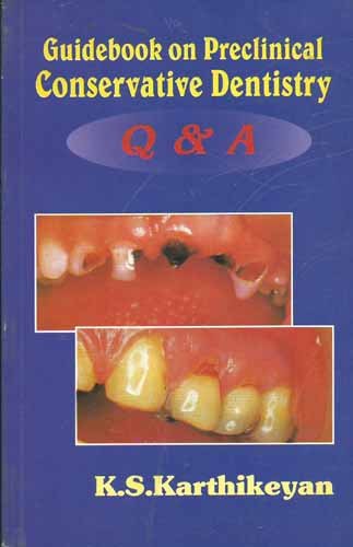 Beispielbild fr Guidebook on Preclinical Conservative Dentistry Q & A zum Verkauf von Books Puddle