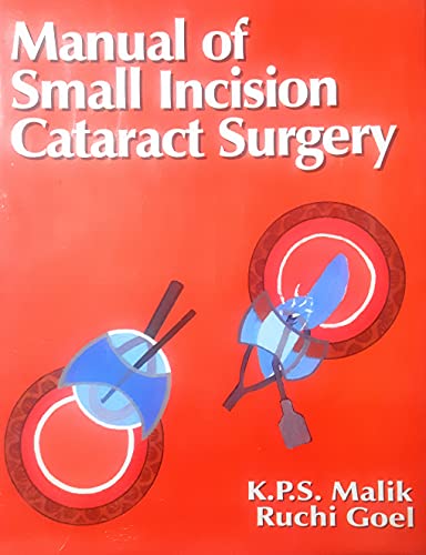 9788123909578: Manual of Small Incision Cataract Surgery