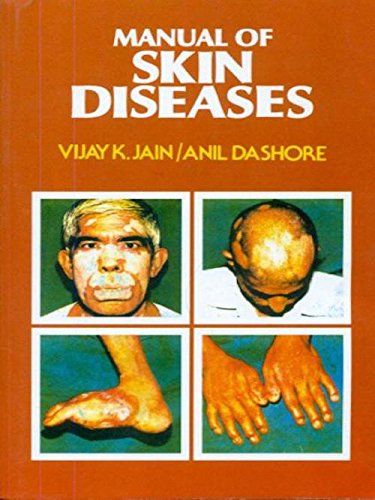 Stock image for Manual Of Skin Diseases for sale by Books in my Basket