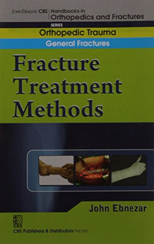 9788123920757: John Ebnezar CBS Handbooks in Orthopedics and Factures: Orthopedic Trauma General Fractures: Fracture Treatment Methods