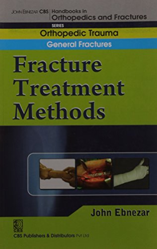 Stock image for Fracture Treatment Methods for sale by Books Puddle
