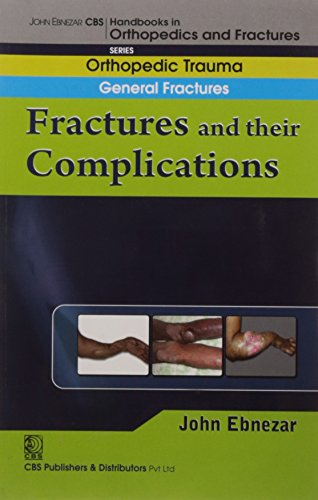 9788123920764: John Ebnezar CBS Handbooks in Orthopedics and Factures: Orthopedic Trauma General Fractures: Fractures and their Complications