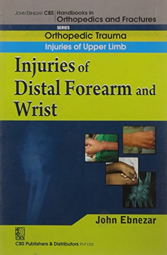 Imagen de archivo de Injuries Of Distal Forearm And Wrist (Handbook In Orthopedics And Fractures Series Vol. 10 Orthopedic Trauma Injuries Of Upper Limb a la venta por Books in my Basket