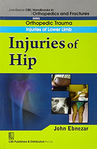 9788123920863: John Ebnezar CBS Handbooks in Orthopedics and Factures: Orthopedic Trauma Injuries of Lower Limb: Injuries of Hip