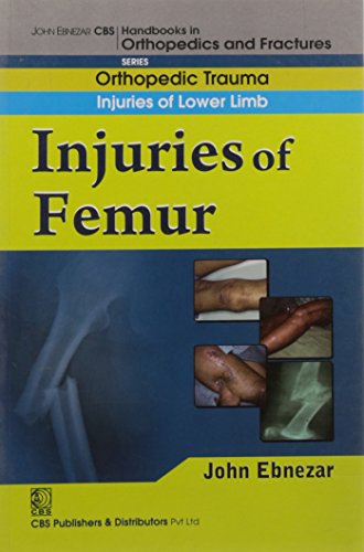 9788123920870: John Ebnezar CBS Handbooks in Orthopedics and Factures: Orthopedic Trauma: Injuries of Lower Limb :Injuries of Femur