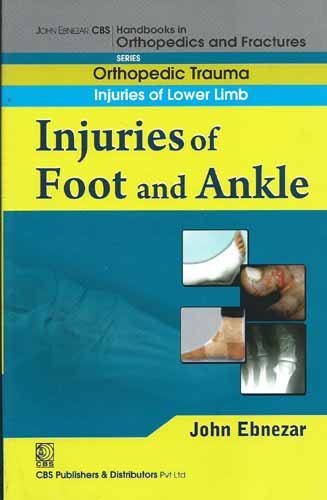 Imagen de archivo de Injuries Of Foot And Ankle (Handbook In Orthopedics And Fractures Series Vol. 18 Orthopedic Trauma Injuries Of Lower Limb a la venta por Books in my Basket