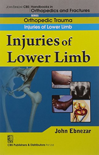 Imagen de archivo de Injuries Of Lower Limb (Handbook In Orthopedics And Fractures Vol. 19 Orthopedic Trauma Injuries Of Lower Limb a la venta por Books in my Basket