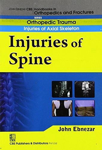 9788123920948: John Ebnezar CBS Handbooks in Orthopedics and Factures: Orthopedic Trauma Injuries of Axial Skeleton :Injuries of Spine