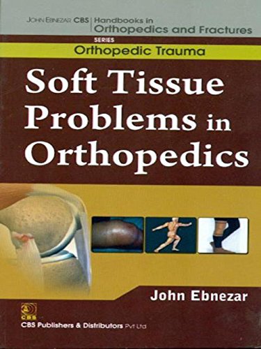 Stock image for John Ebnezar CBS Handbooks in Orthopedics and Factures: Orthopedic Trauma: Soft Tissue Problems in Orthopedics for sale by GF Books, Inc.