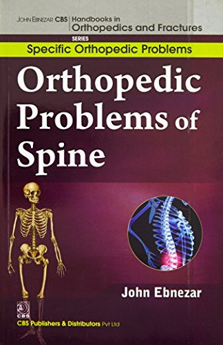 9788123921167: John Ebnezar CBS Handbooks in Orthopedics and Factures: Specific Orthopedic Problems: Orthopedic Problems of Spine