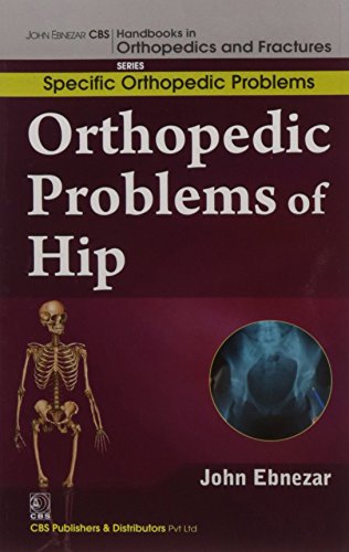 9788123921181: John Ebnezar CBS Handbooks in Orthopedics and Factures: Specific Orthopedic Problems: Orthopedic Problems of Hip