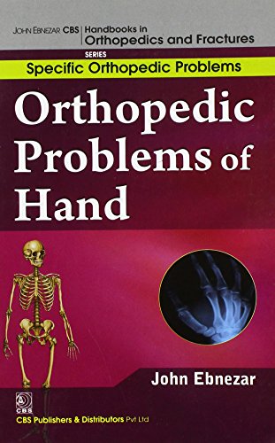 9788123921259: John Ebnezar CBS Handbooks in Orthopedics and Factures: Specific Orthopedic Problems: Orthopedic Problems of Hand